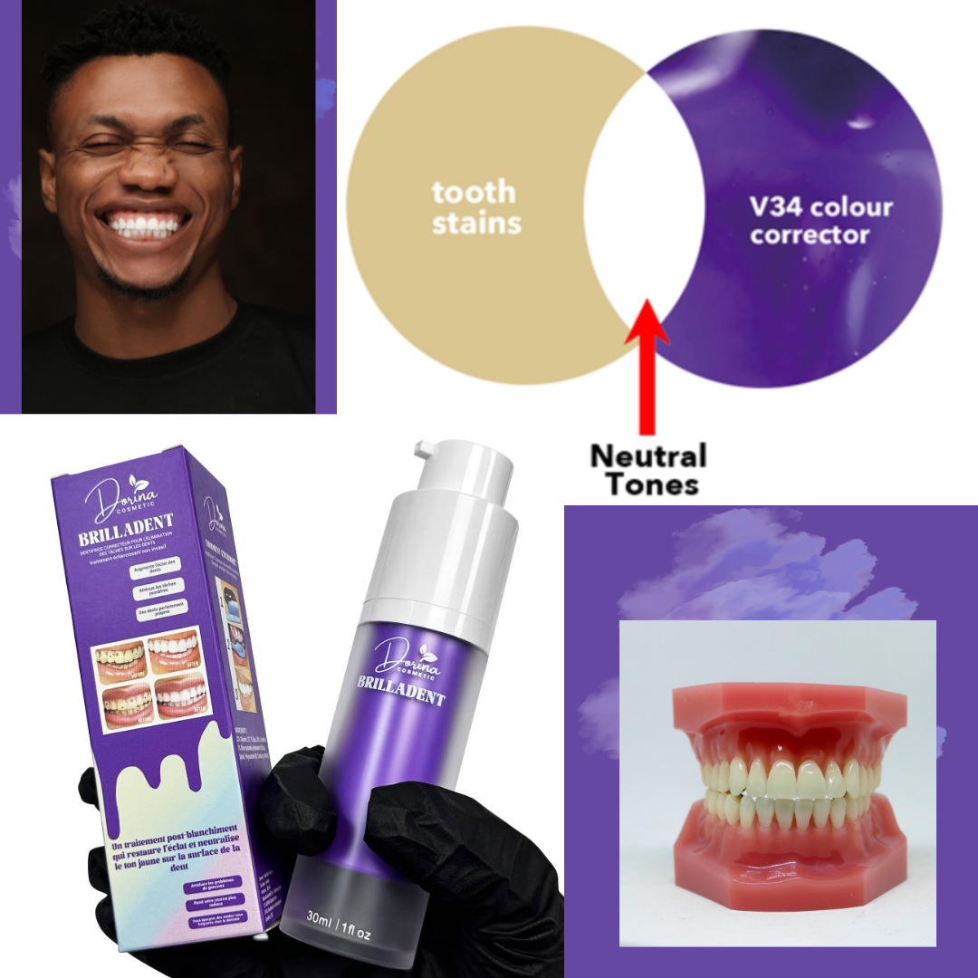 Tooth whitening serum - non-invasive V34 treatment